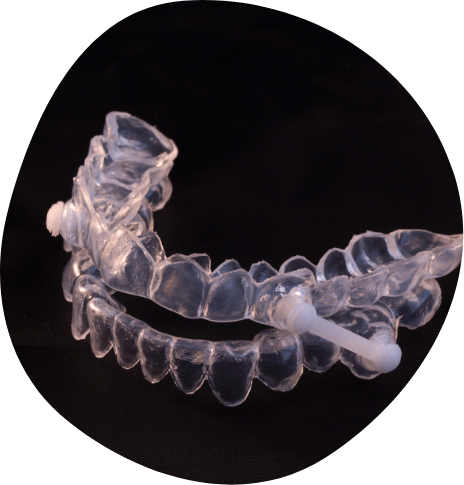 Clear oral appliance against black background