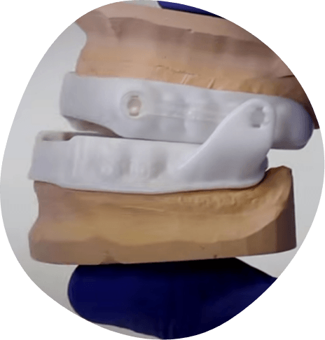 Oral appliances over a model of the jaws