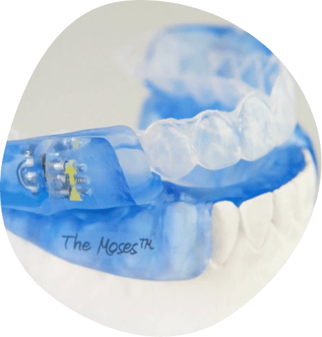 Blue oral appliance